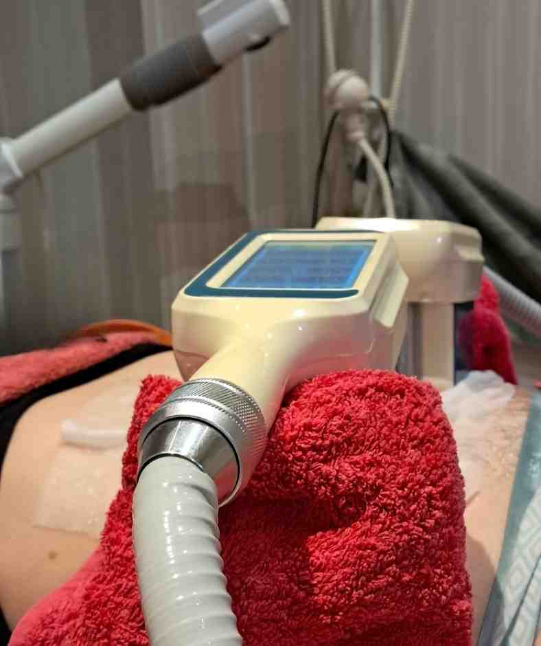 Séance de Cryolipolyse dans l'institut Biotizen